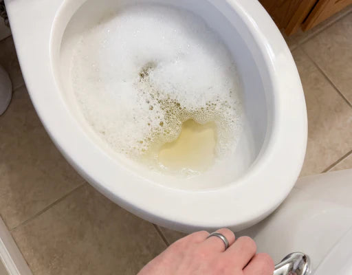 You noticed foam or bubbles in your urine that weren't there before — and it won't go away no matter how much water you drink.